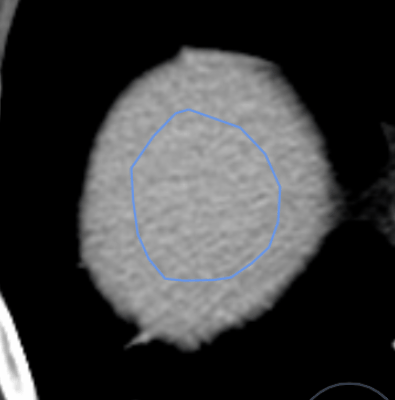 Contour-sculpt-edit.gif