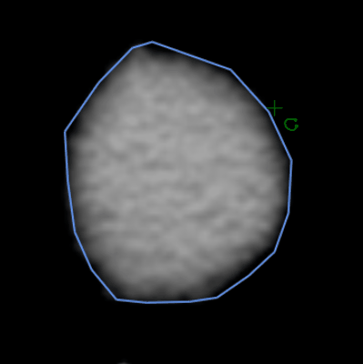 Contour-edit.gif